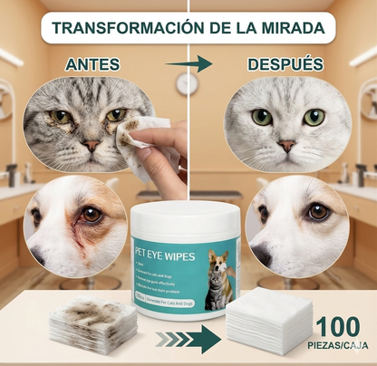 Toallitas limpiadoras de ojos